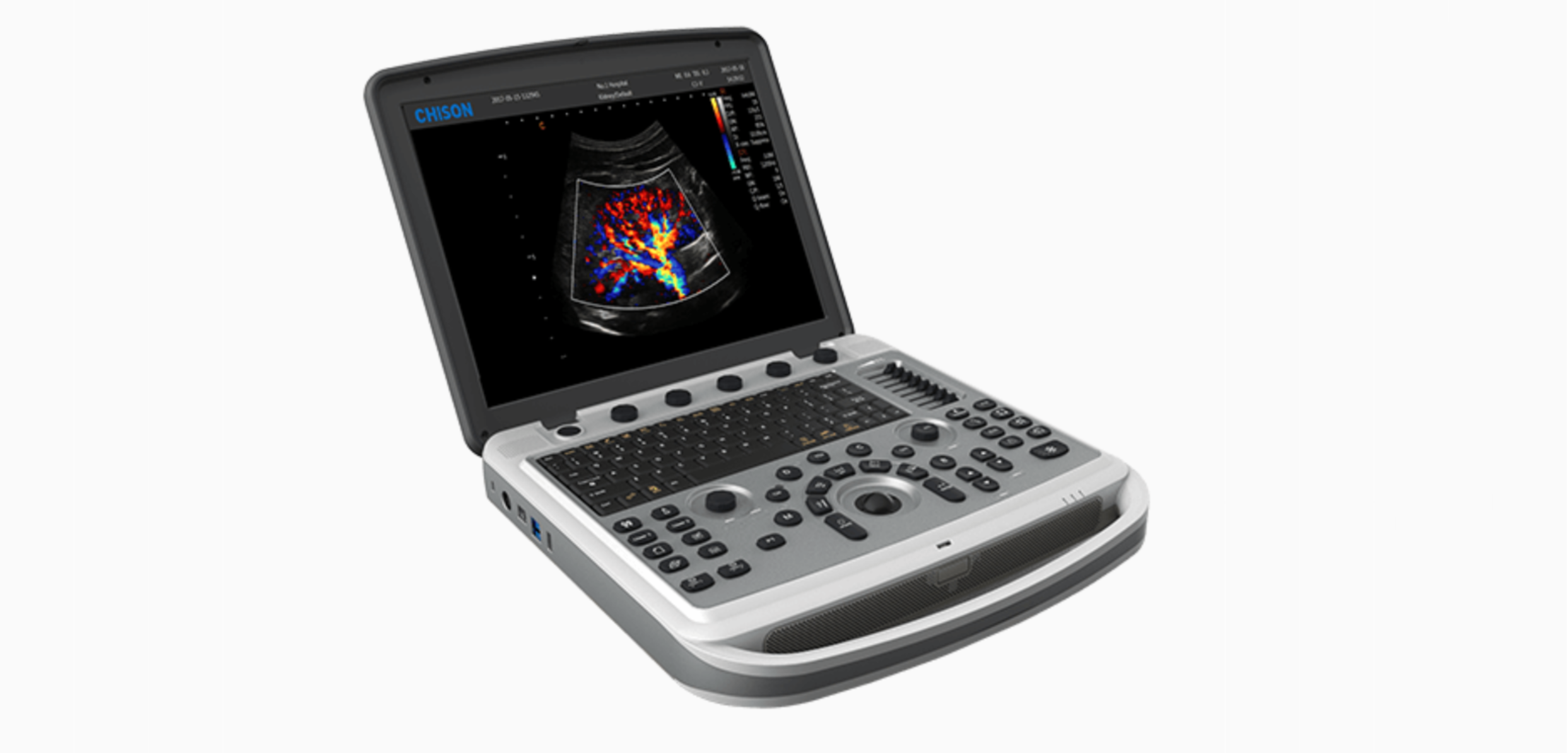 CHISON SonoBook 6 Portable Ultrasound